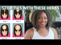 DHT Blocking Hair Oil
