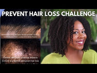 Prevent Hair Loss Kit